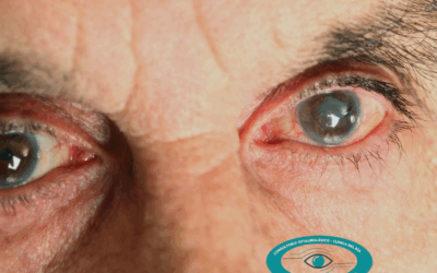 Degeneración macular en Cuenca: cómo tratarla